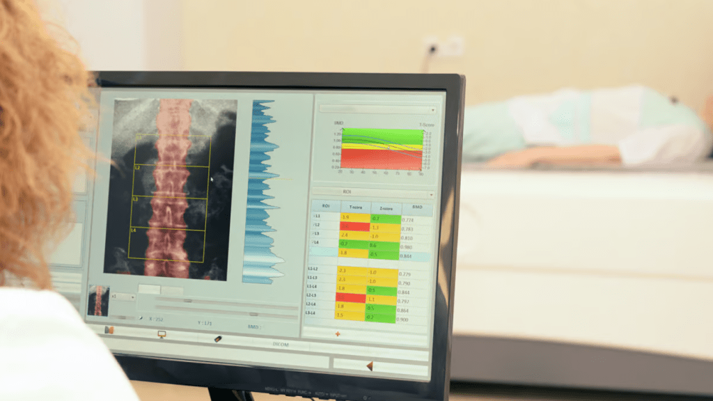 AI Analysis will Predict Future Disease from Bone Density Scans